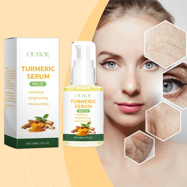 Alt view image 2 of 6 - Turmeric Moisturizing Essence Face Hydrating Moisturizing Skin Refreshing and Not Greasy Moisturizing Dry Skin