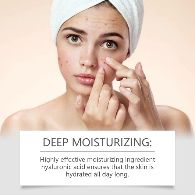 Alt view image 4 of 6 - West Month Oil-Control Hydrating Facial Cream for Refreshing Skin & Condition Improvement