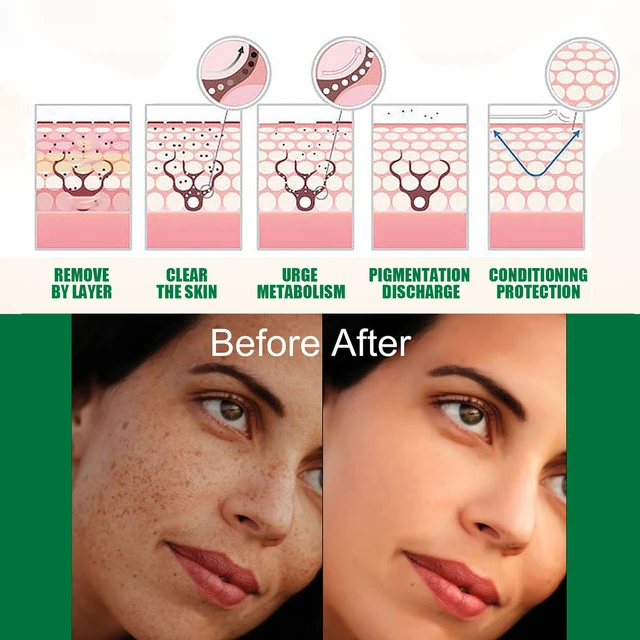 Alt view image 4 of 6 - Radiance Serum for Dark Spot Reduction & Hydration - Daily Facial Care Essence