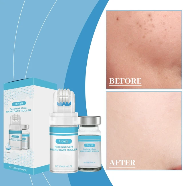 Main image of Hyaluronic Acid Facial Roller Serum for Daily Moisturizing and Skin Radiance Boost