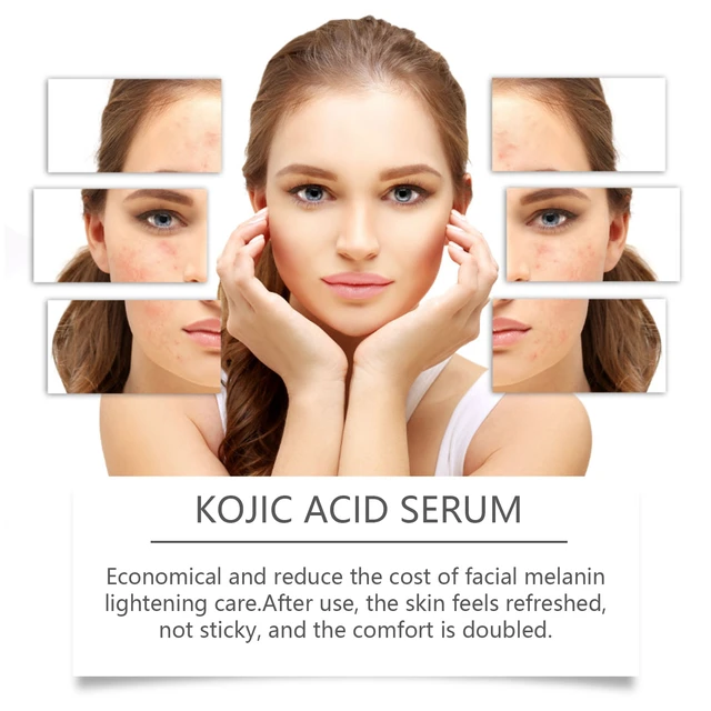 Alt view image 4 of 6 - West Month Kojic Acid Face Essence Toner Hydrating Daily Skincare Lotion