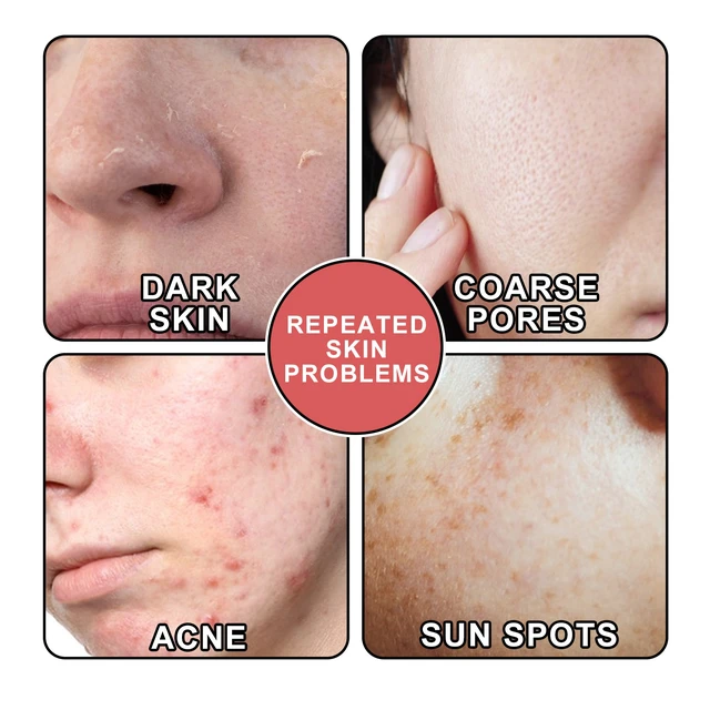 Alt view image 3 of 6 - Firming & Cleansing Skin Care Serum, Niacinamide Facial Essence - Hydrating