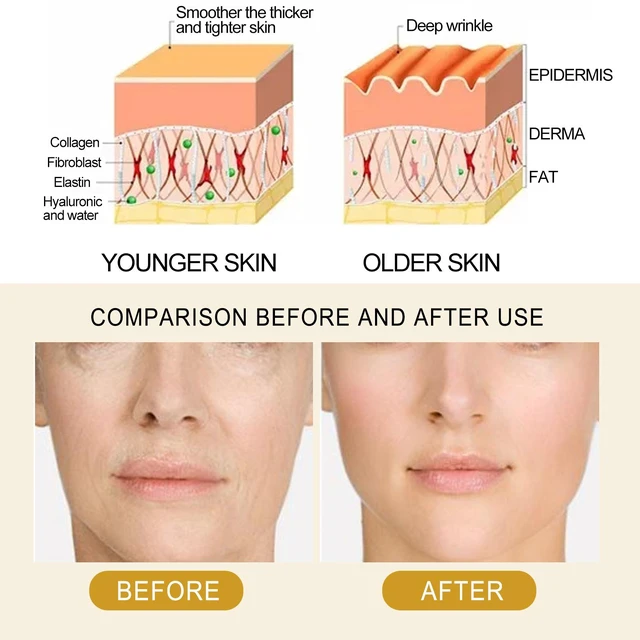 Alt view image 4 of 5 - and Reducing Fine Lines, Firming, Moisturizing, Hydrating, Collagen Serum for Facial Skin Care