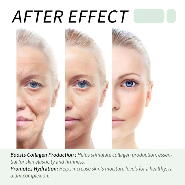 Alt view image 3 of 5 - Tightens Skin & Reduces Wrinkles, 5-in-1 Anti-Aging Facial Serum