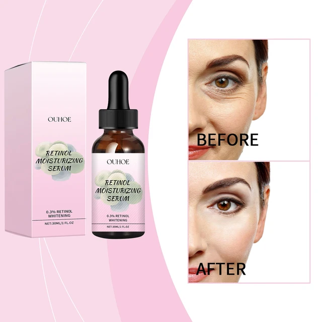 Alt view image 2 of 6 - RetinolFacial Essence - Anti-Aging & Hydrating Serum for Wrinkles and Fine Lines