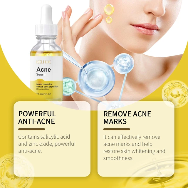 Alt view image 3 of 6 - Effective on Closed Comedones, Gentle Facial Essence for Acne Cleansing & Repair
