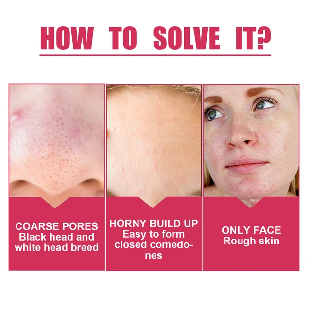 Alt view image 3 of 6 - Whitening & Wrinkle Reduction Benefits, Anti-Aging Pore Minimizing Cream with Moisturizing