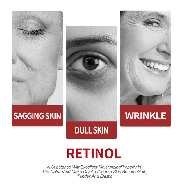 Alt view image 3 of 6 - Retinol Hydrating Face Cream for Fine Line Reduction and Skin Moisturizing Care