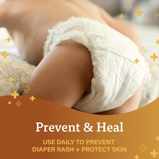 Alt view image 4 of 6 - A+D Original Diaper Rash Ointment 1.5oz, Prevents and Protects Against Diaper Rash, Moisturizing Skin Protectant with Vitamins A and D, for Dry and Cracked Skin