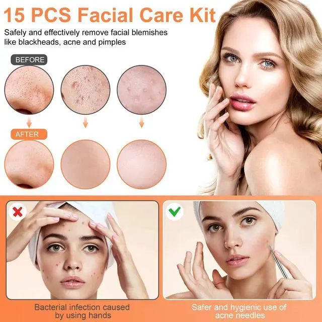 Alt view image 5 of 7 - IUMAKEVP 15PCS Professional Stainless Steel Blackhead Remover Comedone Extractor Acne Removal Kit with Metal Case (Silver)
