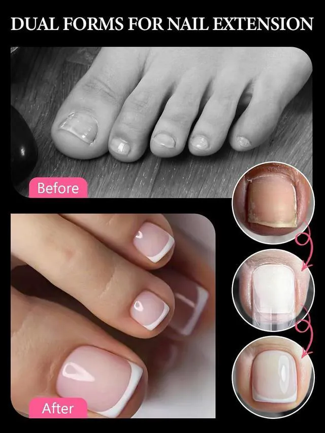 Alt view image 6 of 6 - EBANKU Poly Gel Toenail Kit with Dual Nail Forms, Reusable