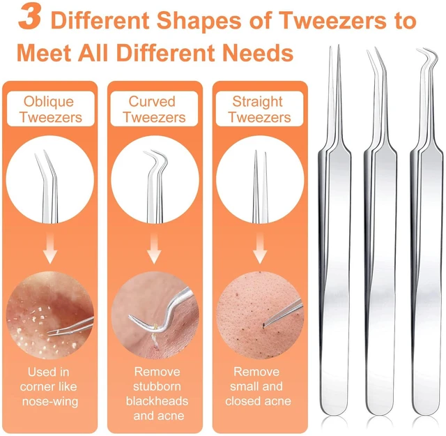 Alt view image 2 of 7 - IUMAKEVP 15-Piece Professional Stainless Steel Blackhead Remover Comedone Extractor Tool Kit for Acne Removal - Includes Metal Case (Silver)