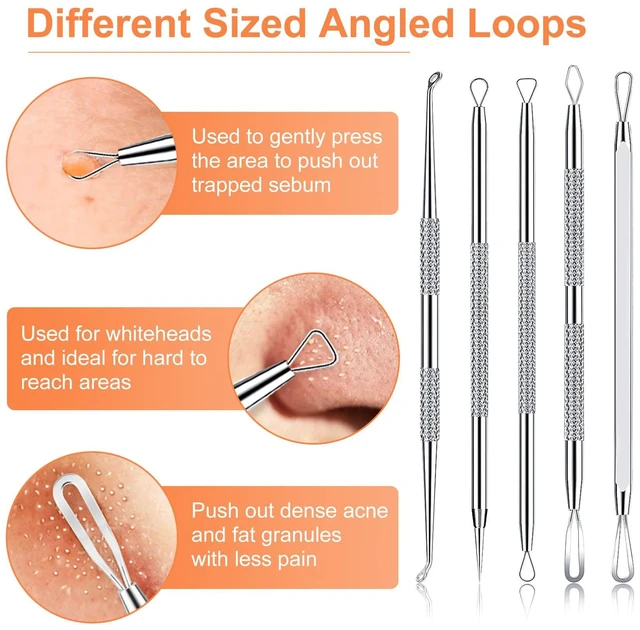 Alt view image 6 of 7 - IUMAKEVP 15-Piece Professional Stainless Steel Blackhead Remover Comedone Extractor Tool Kit for Acne Removal - Includes Metal Case (Silver)