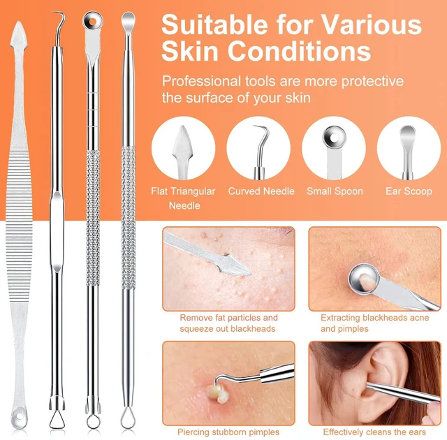 Alt view image 3 of 7 - IUMAKEVP 15-Piece Professional Stainless Steel Blackhead Remover Comedone Extractor Tool Kit for Acne Removal - Includes Metal Case (Silver)
