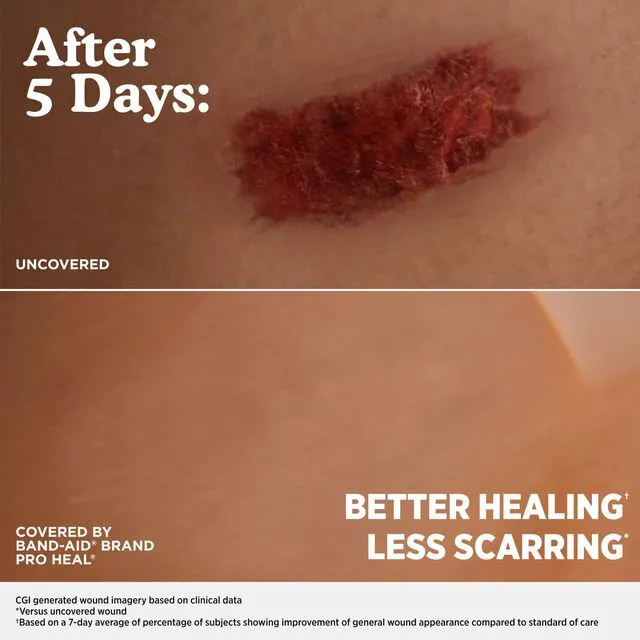 Alt view image 2 of 6 - BAND-AID Pro Heal 5 Day Protect Hydrocolloid Blister Bandages, 6 Ct