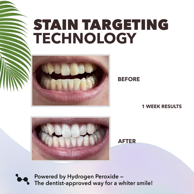 Alt view image 5 of 6 - Purli Teeth Whitening Strips 9-Day Treatment for Sensitive People, Natural Coconut Oil, Professional Effects, Gum & Enamel Safe, Dry Strip