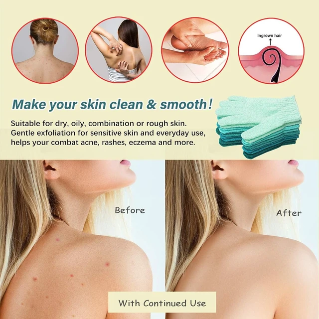 Alt view image 5 of 6 - Deep Cleansing Bath Sponge Loofah for Dead Skin Removal & Washing, Body Exfoliating Scrub Gloves