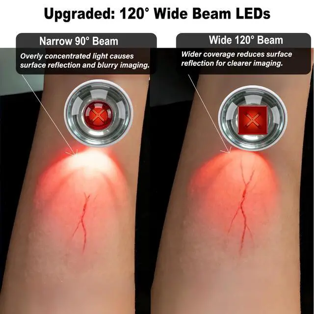 Alt view image 3 of 6 - Portable Vein Finder for IV Access Hand Held Vein Locator Device Type-C Charging Suitable for All Skin Tones, Nurses, Doctors and Home Use (White)