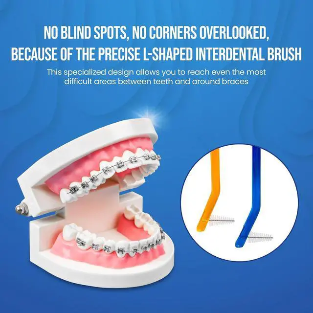Alt view image 5 of 7 - Toothbrush for Braces, Soft Head Braces Toothbrush, V Trimmed Design 2-Pack | Quick Orthodontic Cleaning | Deep Clean Braces at Home (Pack of 2)