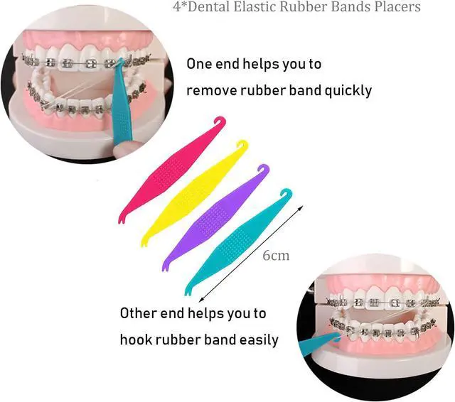 Alt view image 3 of 3 - Oral Care Disassembly Kit/7pcs Including 1 Retainer Case with Mirror and Vent Holes | 1 Aligner Remover Tool | 4 Elastic Rubber Bands Placers | 1 Cleaning Brush (Black)