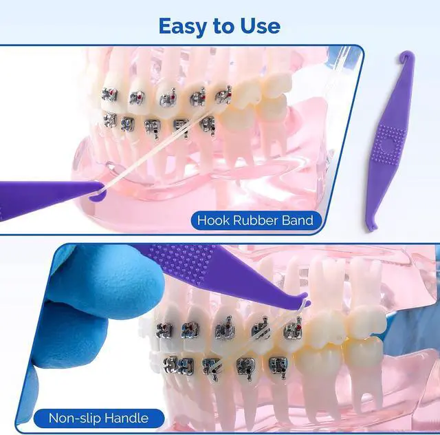 Alt view image 6 of 7 - JMU Orthodontic Elastics 5/16 Medium, 500 Pack Dental Rubber Bands Latex
