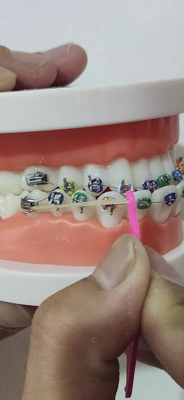 Alt view image 4 of 6 - RZJZGZ Dental Elastic Rubber Bands Placers for Braces Disposable Plastic Orthodontic Elastic Placers Multi-color (15PCS)