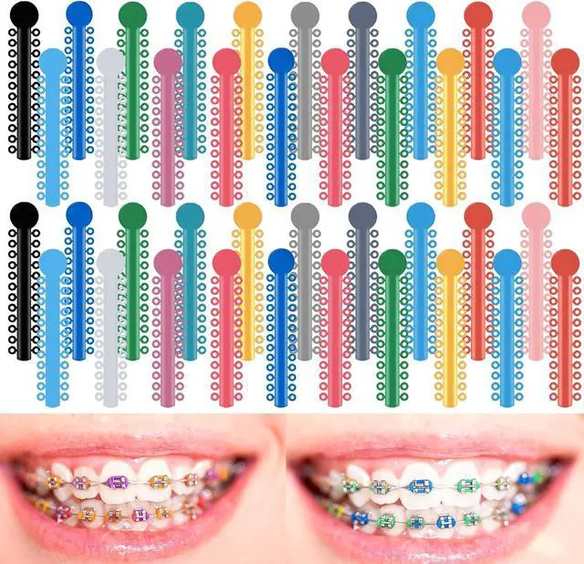 Main image of TTKBHHQ-1040pcs Orthodontic Ligature Ties Multi-Color Orthodontic Elastomeric O-Rings Braces Rubber Bands,26 O-ring ligatures per unit (Mixed Colors)