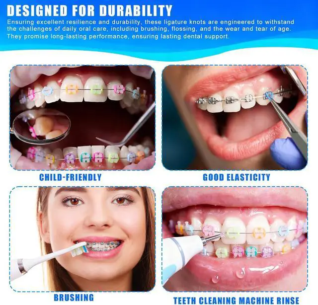 Alt view image 5 of 7 - TTKBHHQ-1040pcs Orthodontic Ligature Ties Multi-Color Orthodontic Elastomeric O-Rings Braces Rubber Bands,26 O-ring ligatures per unit (Mixed Colors)