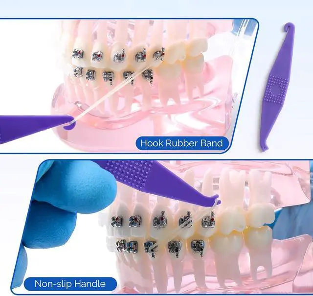 Alt view image 3 of 6 - JMU 20Pcs Braces Rubber Band Tool, Dental Elastic Rubber Bands Placers for Braces, Disposable Plastic Orthodontic Elastic Placers Multi-color