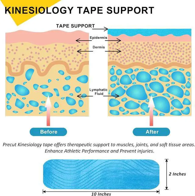 Alt view image 3 of 7 - 2 Pack Kinesiology Tape Precut, 40 Athletic Strips for Knee Shoulder