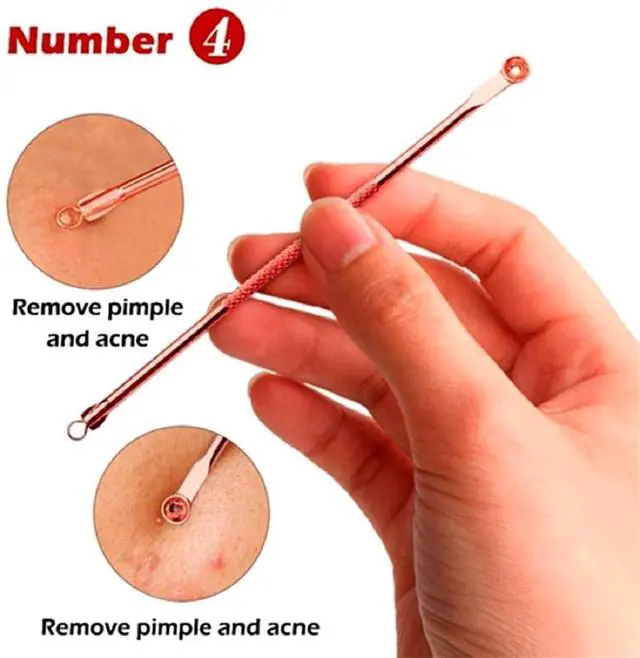 Alt view image 3 of 6 - Blackhead Remover Pimple Comedone Extractor Tool Acne Removal Kit 4 Piece Set with Case for Nose Face Skin - Rose