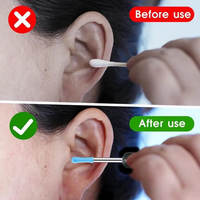 Alt view image 6 of 7 - 30 Pcs Ear Wax Removal Replacement Tips for Wet/Dry Ear Wax Cleaning, Ear Spoons Accessories Set for Adults for Ear Wax Removal Endoscope
