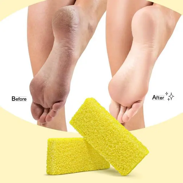 Alt view image 2 of 7 - Disposable Foot Scrubber Sponge Pads Pedicure Pumice Stone for Feet Callus Remover Medium Coarse Yellow 40Pcs