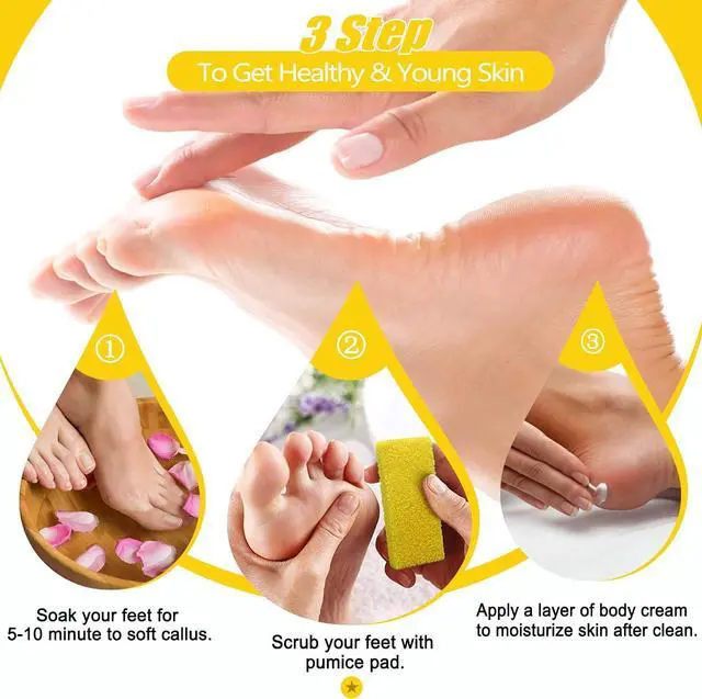 Alt view image 3 of 7 - Disposable Foot Scrubber Sponge Pads Pedicure Pumice Stone for Feet Callus Remover Medium Coarse Yellow 40Pcs