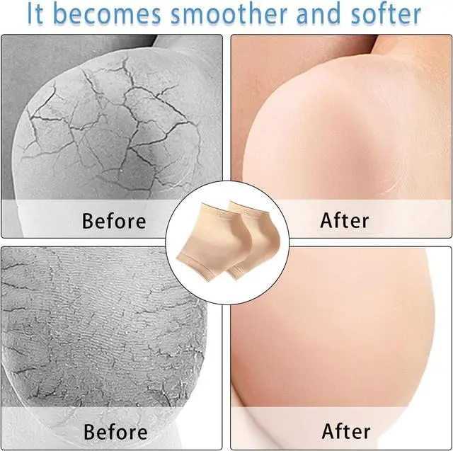 Alt view image 5 of 6 - Moisturizing Socks for Women Overnight,2 Pairs Heel Socks Gel Socks for Dry Cracked Feet Sleep