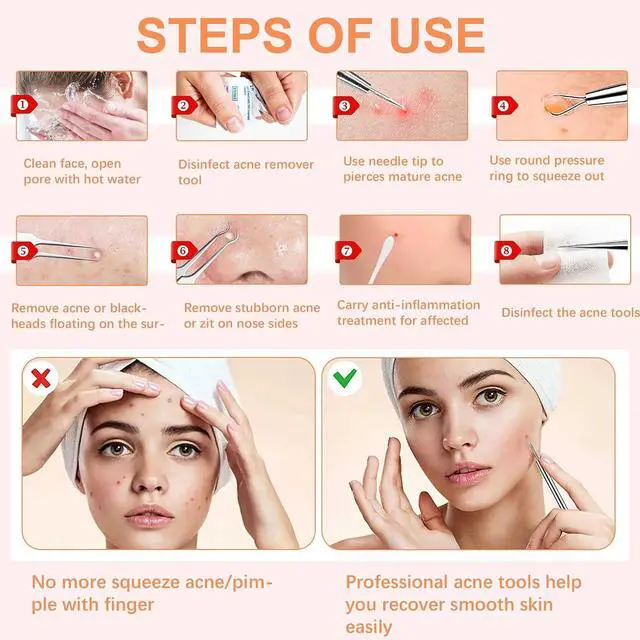 Alt view image 7 of 7 - Blackhead Tweezers, Milia Remover,Ingrown Hair Tweezers | Pimple Popper Tool,Blackhead Extractor