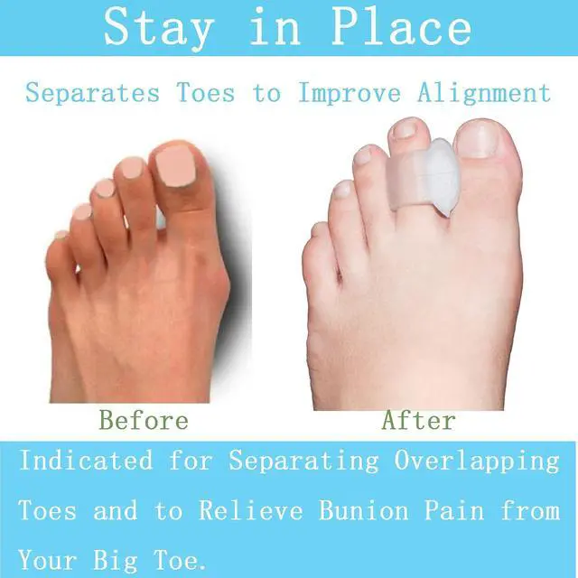 Alt view image 4 of 7 - Pack of 12 Gel Toe Separator, (1/4" Thick) Big Toe Spacers, Single Loop Toe Spreader for Bunions, Overlapping Toe, Corrector and Spacer (Clear)