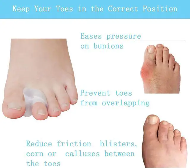 Alt view image 3 of 7 - Pack of 12 Gel Toe Separator, (1/4" Thick) Big Toe Spacers, Single Loop Toe Spreader for Bunions, Overlapping Toe, Corrector and Spacer (Clear)