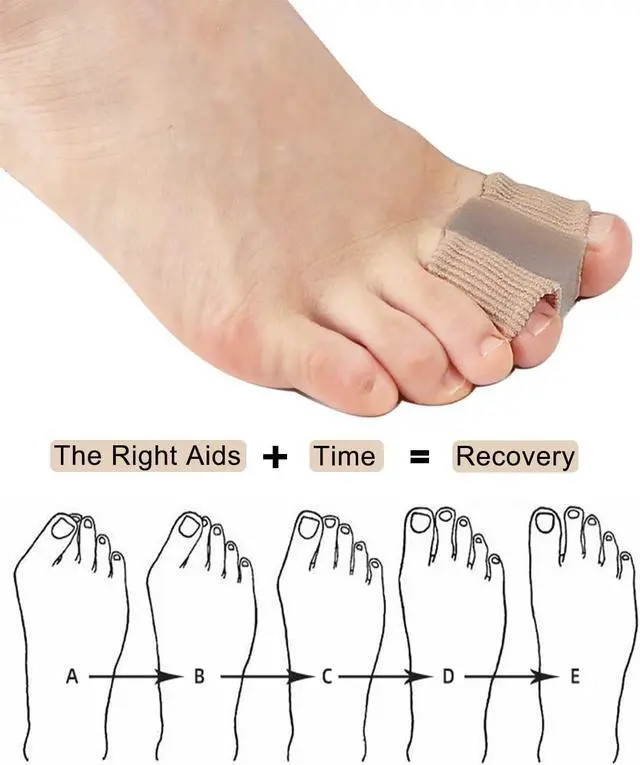Alt view image 2 of 6 - Golbylicc Bunion Toe Separators for Overlapping Toes Women Men, Gel Toe Spacers Bunion Corrector with 2 Loops for feet, Hammer Toe Straightener (2PC)