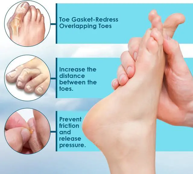 Alt view image 4 of 7 - 12 Packs Foam Toe Separator - Kimihome Toe Gasket-Redress Overlapping Toes, Prevent Friction and Release Pressure, Relieve The Pain Caused by Bunions