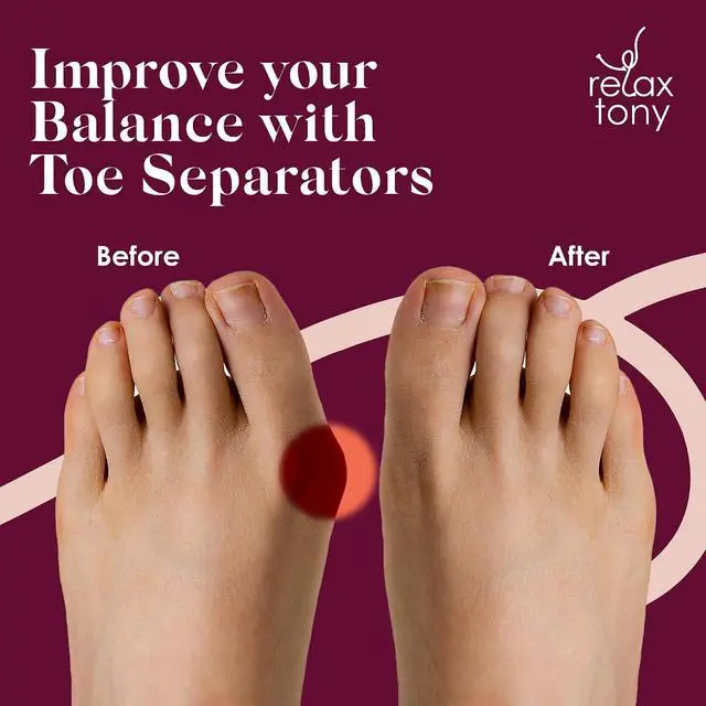 Alt view image 7 of 7 - Gel Toe Separators, Spreaders & Straighteners | Hammer Toe Separator to Relieve Foot Pain & Correct Toes | Toe Spacers for Feet with Overlapping Toes | Bunion Corrector for Women & Men