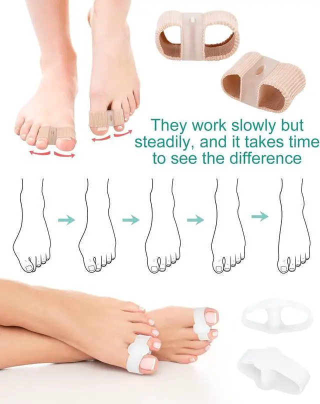Alt view image 5 of 6 - 4Pcs Toe Separators Bunion Corrector for Women Men, Gel Big Toe Spacers with 2 Loops for Feet, Hammer Toe Straightener, Elasticity and Soft (2Nylon+2Gel)