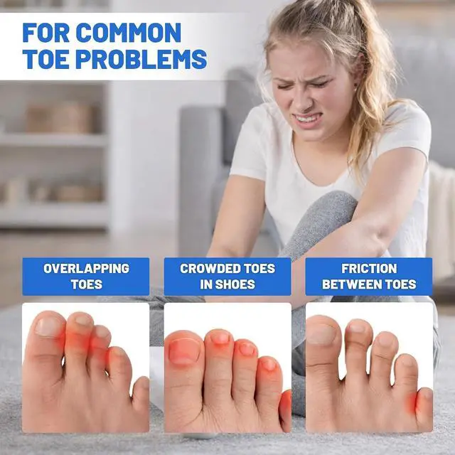 Alt view image 2 of 7 - 40PCS Premium Foam Toe Separators & Toe Cushions, Soft Foam Toe Spacers for Overlapping Toes, Individual Toe Separators, Between Toes Cushion Pads for Women and Men, Toe Dividers, Foot Care