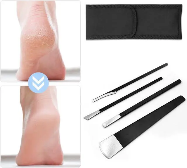 Alt view image 3 of 6 - 4 PCS Pedicure Knife Set Stainless Steel Ingrown Toenail Knife Correction Foot Scraper Clipper Pedicure Nail Remover Kit with Storage Bag for Calluses Beauty Salon Home Use Foot Care - Black