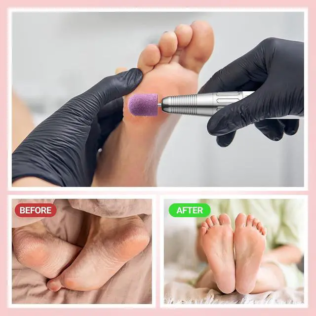 Alt view image 4 of 7 - MelodySusie 10 Pcs Nail Sanding Caps Nail Drill Bits 180 Fine Grit for Foot File Callus Remover Manicure Pedicure Nail Polishing Burr Home Salon Use, Purple (13mm)