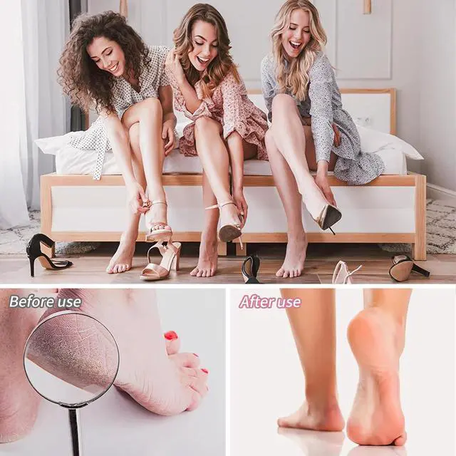 Alt view image 4 of 7 - Topmeet Foot File for Dead Skin - Dual Sided Foot Rasp Callus Removers, Professional Pedicure Tool for Soft, Smooth Feet (White)