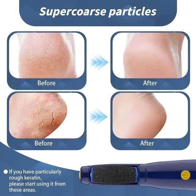 Alt view image 4 of 7 - 8 pcs Replacement Roller Compatible with Dr. Scholl's | Callus Remover Electronic Foot File-Extra Coarse,Perfect for Travel,for Women&Men