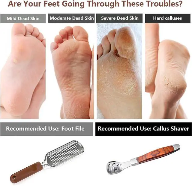 Alt view image 5 of 6 - 2 Pack Pedicure Kit, Foot File Callus Remover, Heel Scraper for Feet | Stainless Steel Foot Rasp & Wood Handle Callus Shaver (10 Replacements and 1 File Foot Head), Callus Remover for Feet