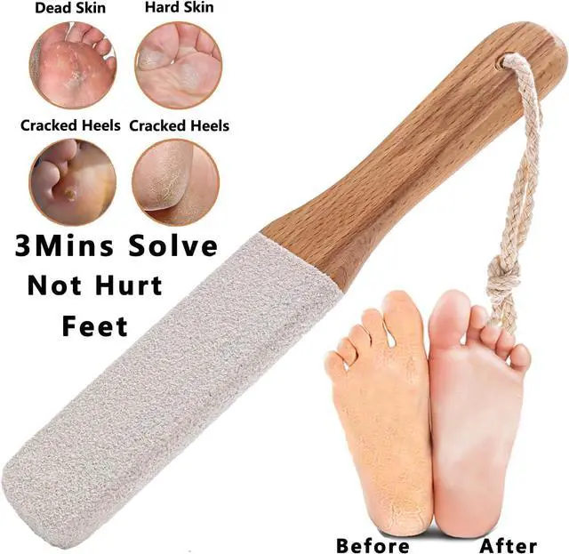 Alt view image 3 of 6 - Kinepi Callus Remover Foot File, Pumice Stone for Feet Scrubber Wet and Dry | Wooden pedicure foot rasp helps smooth dead skin, cracked heels, and hard skin for daily or weekly care after shower