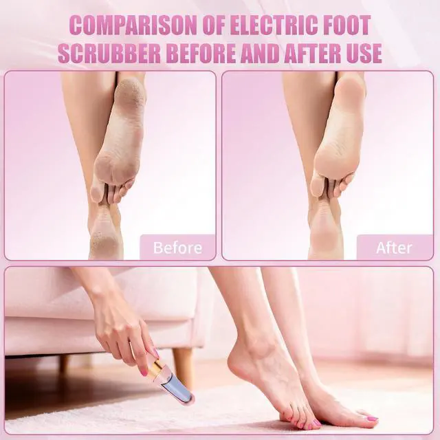 Alt view image 5 of 7 - Pedicure Tool, Foot Callus Remover, Electric Pedicure Set, Foot Care, Removes Rough Dead Skin on The Feet, Making Your Feet Smooth. (Pink)